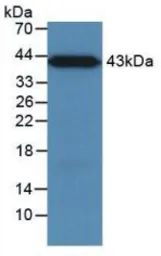 Human MBL2 protein, His and GST tag. GTX00127-pro