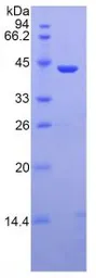 Human MBL2 protein, His and GST tag. GTX00127-pro