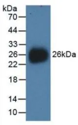 Human NEU1 protein, His tag. GTX00129-pro