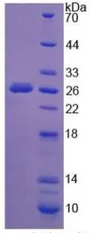 Human NEU1 protein, His tag. GTX00129-pro