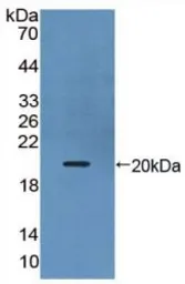 Human IL17B protein, His tag (active). GTX00134-pro