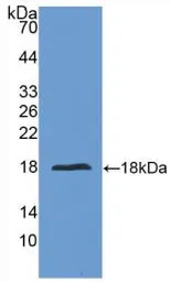 Human IL24 protein, His tag (active). GTX00138-pro