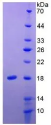 Human IL24 protein, His tag (active). GTX00138-pro