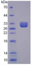 Human CLCA1 protein, His tag. GTX00147-pro