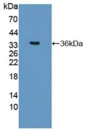 Human Arginase 1 protein, His tag. GTX00168-pro