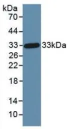 Human DKK1 protein, His tag. GTX00188-pro