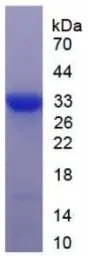 Human DKK1 protein, His tag. GTX00188-pro