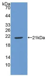 Human IL22 protein, His tag. GTX00189-pro