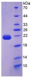 Human IL22 protein, His tag. GTX00189-pro