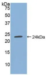 Human TIMP4 protein, His tag. GTX00229-pro