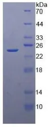 Human TIMP4 protein, His tag. GTX00229-pro