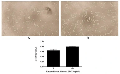 Human EPO protein, His tag (active). GTX00251-pro