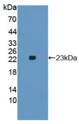 Human IL1 alpha protein, His tag (active). GTX00264-pro