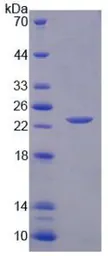 Human IL1 alpha protein, His tag (active). GTX00264-pro