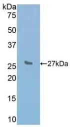 Mouse IL2 Receptor beta protein, His tag. GTX00290-pro