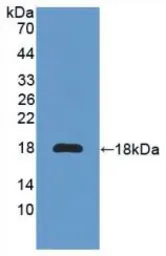 Mouse IL6 Receptor protein, His tag. GTX00297-pro