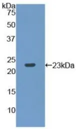 Rat RPP40 protein, His tag. GTX00344-pro