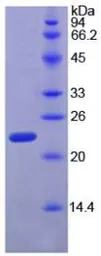 Rat RPP40 protein, His tag. GTX00344-pro