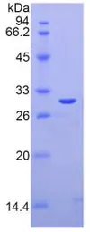 Rat Galectin 3 protein, His tag (active). GTX00361-pro