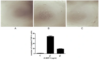 Human MCP1 / CCL2 protein, His tag (active). GTX00415-pro