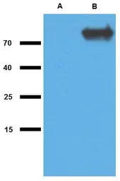 Anti-Mycobacterium tuberculosis GlcB antibody [PAb (192)] used in Western Blot (WB). GTX00496