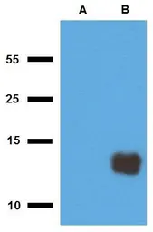 Anti-Mycobacterium tuberculosis Tb10.3 antibody [PAb (187)] used in Western Blot (WB). GTX00499