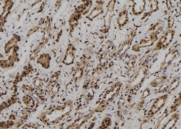 Anti-RyR2 (phospho Ser2808) antibody used in IHC (Paraffin sections) (IHC-P). GTX00625