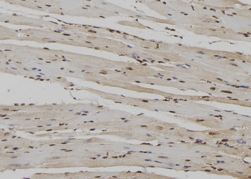 Anti-RyR2 (phospho Ser2808) antibody used in IHC (Paraffin sections) (IHC-P). GTX00625