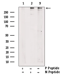 Anti-RyR2 (phospho Ser2808) antibody used in Western Blot (WB). GTX00625