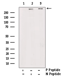 Anti-RyR2 (phospho Ser2814) antibody used in Western Blot (WB). GTX00626