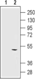 Anti-KCNN4 antibody [6C1] used in Western Blot (WB). GTX00627