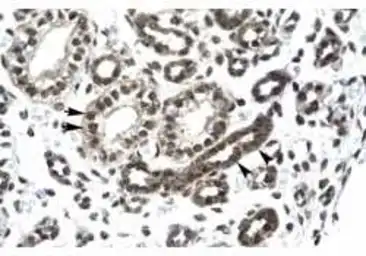 Anti-PTHLH antibody used in IHC (Paraffin sections) (IHC-P). GTX00631