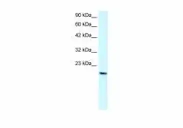 Anti-PTHLH antibody used in Western Blot (WB). GTX00631