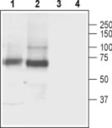 Anti-GAT3 antibody used in Western Blot (WB). GTX00634