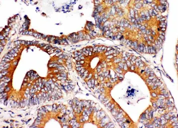 Anti-Integrin alpha 1 antibody used in IHC (Paraffin sections) (IHC-P). GTX00650