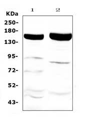 Anti-Xanthine Oxidase antibody used in Western Blot (WB). GTX00652