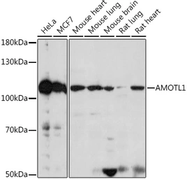 Anti-AMOTL1 antibody used in Western Blot (WB). GTX00660