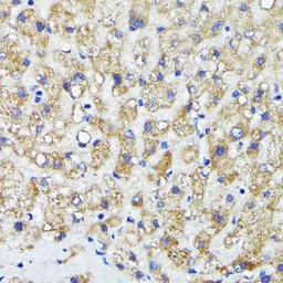 Anti-AMOTL2 antibody used in IHC (Paraffin sections) (IHC-P). GTX00661