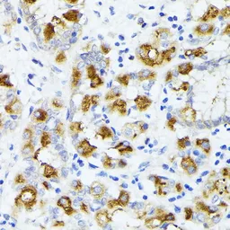 Anti-AMOTL2 antibody used in IHC (Paraffin sections) (IHC-P). GTX00661