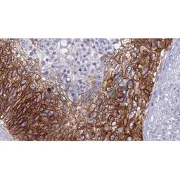 Anti-Claudin 4 antibody used in IHC (Paraffin sections) (IHC-P). GTX00667