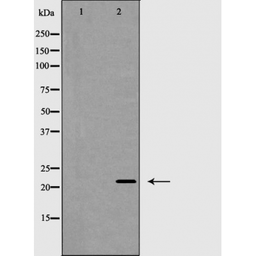 Anti-Claudin 4 antibody used in Western Blot (WB). GTX00667