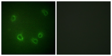 Anti-ENaC Beta (phospho Thr615) antibody used in Immunocytochemistry/ Immunofluorescence (ICC/IF). GTX00671