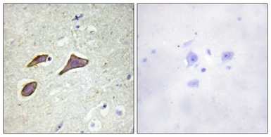 Anti-ENaC Beta (phospho Thr615) antibody used in IHC (Paraffin sections) (IHC-P). GTX00671