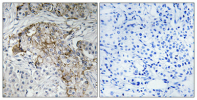 Anti-ENaC Beta (phospho Thr615) antibody used in IHC (Paraffin sections) (IHC-P). GTX00671