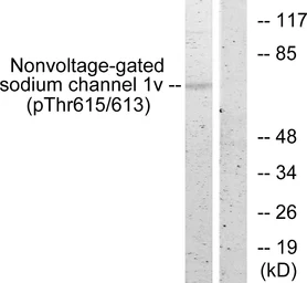 Anti-ENaC Beta (phospho Thr615) antibody used in Western Blot (WB). GTX00671