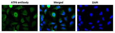 Anti-ATF6 antibody [1-7] used in Immunocytochemistry/ Immunofluorescence (ICC/IF). GTX00687