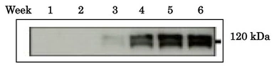 Anti-ADAM1B antibody [#158] used in Western Blot (WB). GTX00690