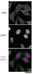 Anti-NUP98 antibody [2H10] used in Immunocytochemistry/ Immunofluorescence (ICC/IF). GTX00697