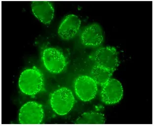 Anti-NUP98 antibody [2H10] used in Immunocytochemistry/ Immunofluorescence (ICC/IF). GTX00697