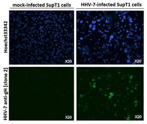 Anti-Herpes virus 7 gH antibody [2] used in Immunocytochemistry/ Immunofluorescence (ICC/IF). GTX00709